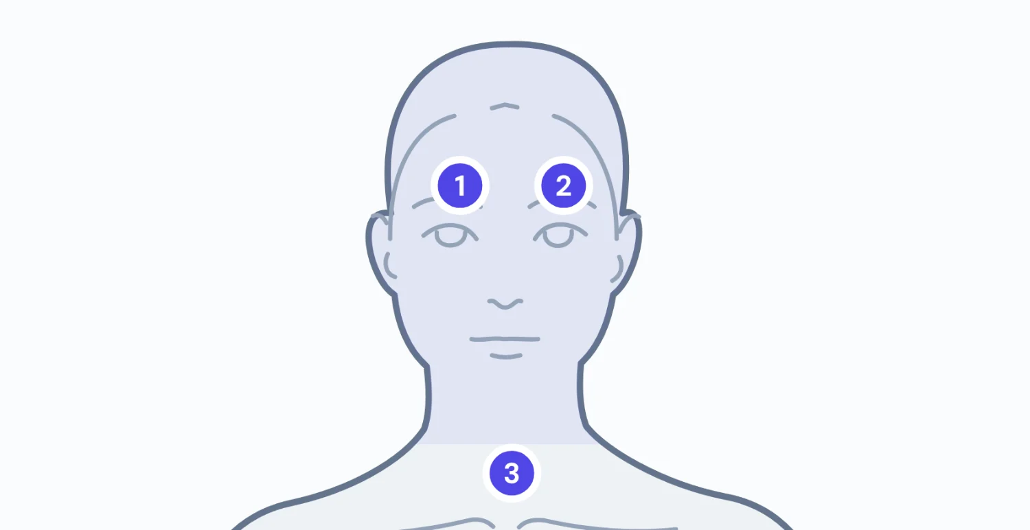 Body chart: tre punti di trattamento numerati, segnati sul viso e sul collo